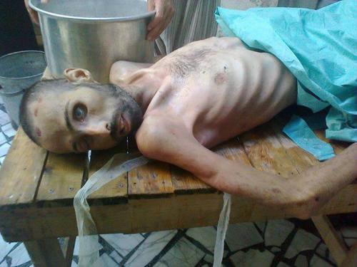 36-year-old Jelal Helal from Aleppo&#8217;s Al Sakhour neighbourhood. He died as a result of torture and starvation in a the Assad regime&#8217;s &#8216;political security&#8217; branch in Aleppo, Syria.
Thanks Radio Free Syria