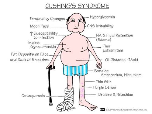 Are you carrying adrenal Cushing's syndrome without knowing it