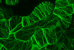 frontal-cortex:  Actin microfilaments in epidermal cells of an Arabidopsis leaf revealed by labelling with a fluorescently-tagged actin-binding protein. The image is a composite of 31 optical sections taken with a Zeiss confocal microscope and encompasses