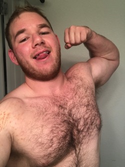 dylanprogress:Had some massage done a few days ago and it left some pretty gnarly marks on my bicep and shoulder. Should go away in a few days. My arms and pecs are feeling much better since the work, though, so that’s great. Hope everyone has a great