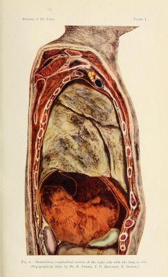surgery of the lung, c. garre and h. quincke, 1913.