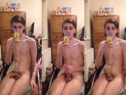 rotting:You can have a colostomy bag and in a wheelchair and be sexy and dirty and hot and whatever and no one can stop you, took these nudes earlier for someone but i actually really like them and i dont see enough people with colostomys being chill