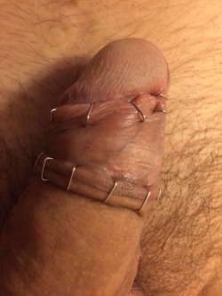 foreskin2cut:Master tortured my foreskin. He stalked it back to make me look and feel like a real cut man  Just cut it!!
