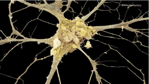 A human neuron. GIF credit: Invention Factory
