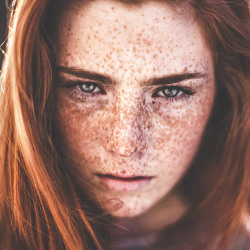 furrycollectionperson-things:Freckle face