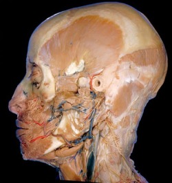A deep dissection of the side of the head shows the many blood vessels (red arteries, blue veins) and nerves (graying white) in the facial region. The hole is the external ear canal. The temporal muscle, used for chewing, is the prominent fan shaped muscl