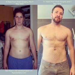 ryansallans:  For #transformationthursday I decided to share a side-by-side photo of where I was 11 years ago, just beginning my transition, to today. All of our bodies are different, how we define our bodies are different. I share these comparisons from