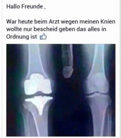 Mein Knie ist wieder ok 😉 my knee is ok again  😉