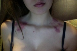 dope-im-mean:  I want to give hickies