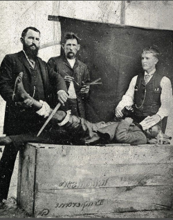 Surgery in 1855.