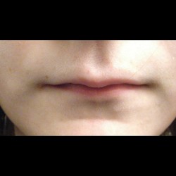If your lips like this&hellip;&hellip;&hellip;..Don&rsquo;t kiss me&hellip;&hellip;&hellip;&hellip;Ever!!!!!!