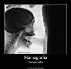 jaidefinichon:  Mamografia 