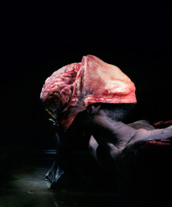 aspiringdoctors:  circle-of-willis:  ether927:  Incredible photos from the operating room taken by Max Aguilera-Hellweg in his book The Sacred Heart, An Atlas Of The Body Seen Through Invasive Surgery, 1997, Bulfinch Press, Little Brown &amp; Company,