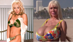 faketitsorbust:  Elizabeth Starr: before and after. If that doesnâ€™t get your cock hard as fuck or your pussy wet as hell, I donâ€™t know what will. cc: beforeandafterbimbos, darkersideofthestone  Polypropylene breast implants, or â€œsilly stringâ€