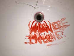 loviely:&ldquo;When we got drunk, he used to hold my hair back. I still feel his hands behind my head. I could blow my fucking brains out.&rdquo;&ldquo;Bathroom Sink Bloody Stories&rdquo; - Part 1 (&ldquo;We were in love?&rdquo; - &ldquo;Why didn’t