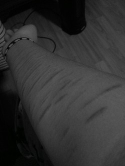 stop-thebleeding:Scars.