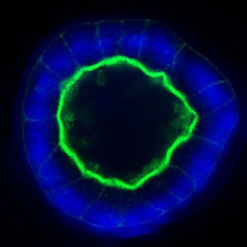 MDCK cyst (hollow clump of cells) with nuclei in blue and actin in green