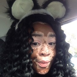 laninjapanama:On #MelaninMonday I was a panda. #vitiligo #vitiligobeauty