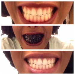 pookaslogic:  I get asked a lot how do I get my teeth so white 😁😄   So here it is. Once every two weeks or so I brush my teeth for five minutes with activated charcoal and then brush with my regular toothpaste after and they are shades whiter as