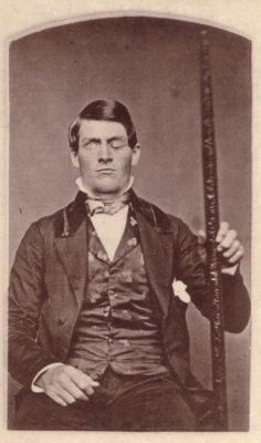 fuckyeahhistorycrushes:  This is Phineas Gage, a railroad worker who survived an accident in which a large metal rod (pictured) passed completely through his skull. The damage that occurred to his frontal lobe completely changed his personality. But not