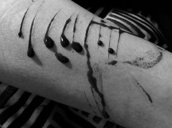 una-chica-decepcionada:  Scars are stories, history written on the body.