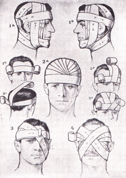 sutured-infection:  First aid bandaging techniques. Richards Topical Encyclopedia, 1962 