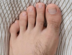 truckee:  feettopslovers:  Thanks for the hot submission!! Love hairy feet!!  Ricky Larkin’s feet 