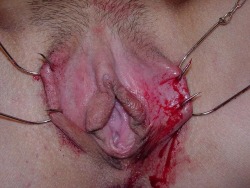 pussymodsgalore  BDSM. Hooked outer labia spread to expose pussy. 