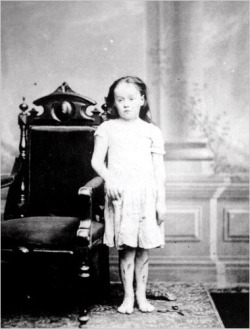 As an eight-year-old, Mary Ellen Wilson was severely abused by her foster parents, Francis and Mary Connolly. Her case of child abuse led to the creation of the New York Society for the Prevention of Cruelty to Children. Image dated 1874.