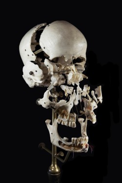 sevenismycatsname:  A Beauchene Skull, also known as an exploded skull, is a disarticulated human skull that has been painstakingly reassembled on a stand with jointed, movable supports that allows for the moving and studying of the skull as a whole or