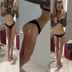 aalixlaidler:  Iâ€™m still on the skinny side but Iâ€™m slowly regaining some weight. I was so pleasantly surprised when I went into the change room after lunch to see some slight curve in my hips aswell as a booty come back. Iâ€™m very nervous to weigh