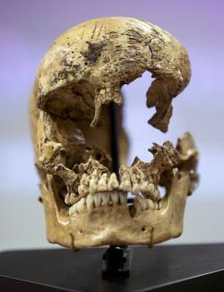 karminny:  sixpenceee:    Skull of a 14 year-old girl believed to be a victim of cannibalism at the Jamestown colony in the winter of 1609. Butchery marks can be seen on forehead   (Source)  Now THIS is how to eat a girl 