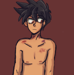 superdiduper: I thinkin of making the reason why Vspe Red’s so reluctant to take off his shirt because he doesnt want anybody to see his gross bruises