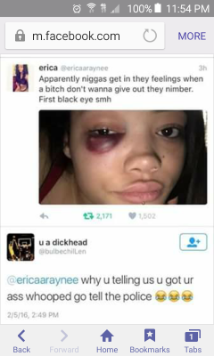 dynastylnoire:  dayumshecangetit:  fedupblackwoman:  angel-of-death-2015 submitted:“Really…? REALLY?!” @angel-of-death-2015 Omg!!! Her eye. I feel sick to my stomach looking at that picture and reading the comments.Those men are absolutely disgusting.