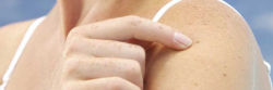 Removing Skin Tags from Under Your Armshttp://www.cliffys.com.au/removal-guide/skin-tags-under-arms/
