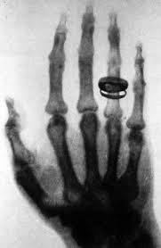 fuckyeahstrangeshit:  the-new-luna:dj-froge:sixpenceee:First Human X-ray 1896. The woman, Marie Curie, who took part in this experiment had so many X-rays taken that she developed a form of blood cancer and died.Took part? TOOK PART????? SHE FUCKIN INVENT