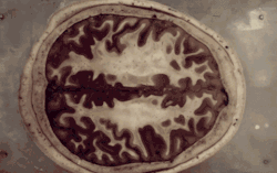 marabao:  medicalschool:  The human brain in cross section  Bienvenidos al mundo de las resonancias magéticas. Digo yo vamos que será RM como mínimo, la precisión es acojonante.
