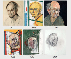 mildlyamused:  An artist with Alzheimer’s drawing self-portraits. Terrible, frightening disease. 