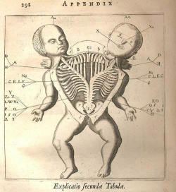 moonfall-requiem:  Anatomical drawing of a Siamese twin. Fortunio Liceti, De monstris, Amsterdam 1665  I’m going to get this tattooed, not sure where yet? 