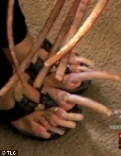 A woman who was once addicted to growing the nails on her hands has now grown her toenails to a staggering four inches.