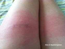 I love/hate having the front of my thighs caned. Pure. Agony. (Done by Malignus, 2012)