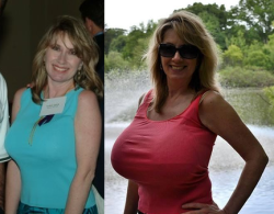 boobgrowth:  The gorgeous Nancy Quill, before and after her breast augmentation. Nancy didn’t have small tits to begin with, but decided to get absolutely massive implants. Her current size is unknown.–Keep the boobies growing! Support Boob Growth