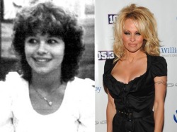10knotes:  You won’t believe which of your favorite celebs have had a nip and tuck! CLICK HERE!   No, I&rsquo;m pretty sure I believe that Pamela Anderson has had some work done a time or two in the past.