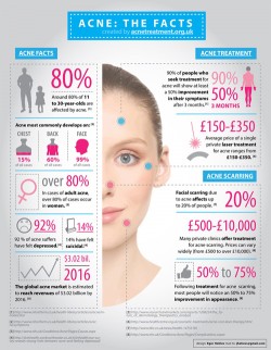 Acne  Infographic, stats include information on adult acne, where acne most  commonly develops, the emotional side of acne, global acne market,  treatment success rate &amp; acne scarring.