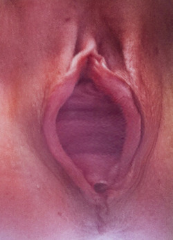 maturesaggyudders:The gape after. Is it too much?