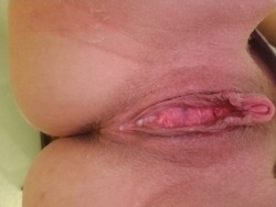 fatgreedypussy:  My meaty slit  Huge clit, big lips, long meaty, gaping prolapsed hole. Even closed it&rsquo;s open and spilling out. A kings feast of a cunt.