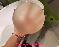 🌸my old 900cc implants😱Mary💕 #hot #getbig #curvesforday #massivemelons #amazingboobs #sexy #breastimplants #plastic #onlyimplants #kickass #babe #amazing #gorgeousgirl #body #sheshot #beautiful #model #biggestbreasts #biggestboobs #instagood