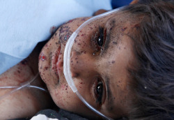 A child receives medical attention during a Medevac mission in southern Afghanistan&rsquo;s Helmand province November 13, 2010. The child was injured in an explosion. (REUTERS/Peter Andrews)