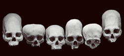 fiebre:  ☲ (by ERiN SiTT) inca skulls with self inflicted cranial deformations.  