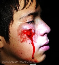 sebastianhumphrey:   Niño de 13 años impactado en el rostro por lacrimogena lanzada por carabineros en la UDEC  El amor al dinero de un gobierno reflejado en las mejillas de un menor. D I F U N D A .  
